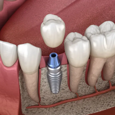 OdontoCenter Clínica Dental - Sonreír Es Parte De Ti